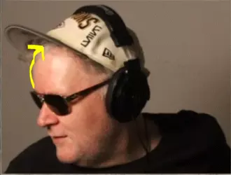 BALD.GIF