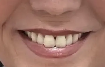 flossieteeth.png
