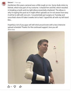 Arm.jpg