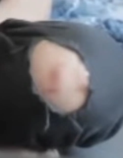 BumKnee.jpg