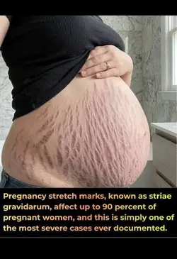 1000004119.jpg