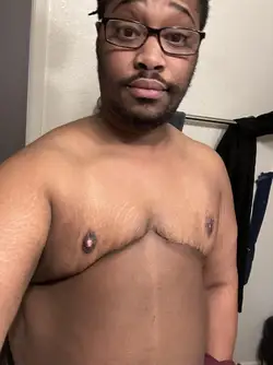 im-black-will-my-nipples-still-be-brown-after-surgery-v0-mbi2fmru3zjc1.jpeg
