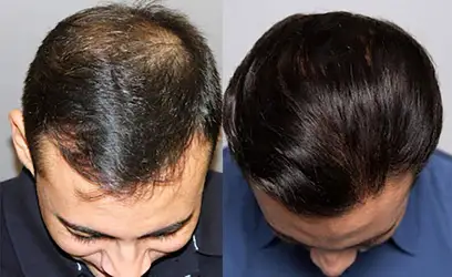 ernic-r-before-and-after.jpeg