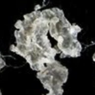 Pube Dandruff