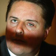 Nick Griffin's Glass Eye