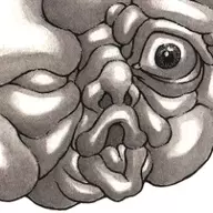 Calcified Fetus