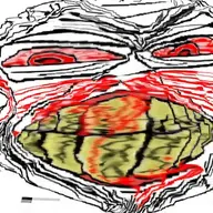 Goonigan