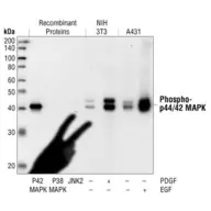 MAPK phosphatase