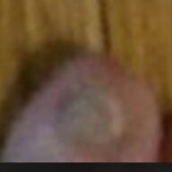 Disgustingfuckingtoenail