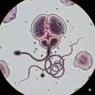 Spermatozoa