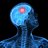 McCain's Brain Tumor