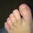 CathysGnarlyFoot