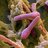 Clostridium Botulinum
