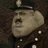 goiter